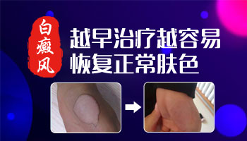 白点疯早期长什么样子