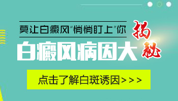 精神压力会导致白癜风出现吗