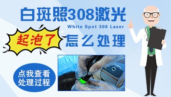 白癜风308光疗后出现水泡怎么回事