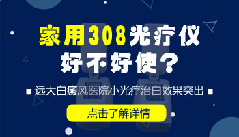 家用308nm准分子光疗仪哪个牌子好