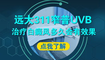 uvb治疗白癜风脱皮还要继续照光吗