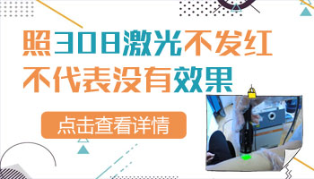 308激光照白癜风后不发红是不是就没有效果