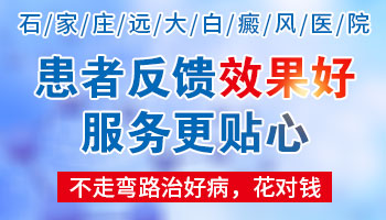 308激光治疗嘴角白癜风怎么收费的