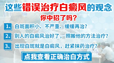 白癜风在伍德灯的照射下图片