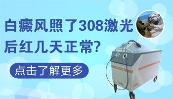 308准分子激光治疗白斑红几天