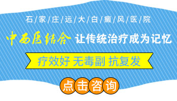 邯郸治疗白癜风最好的医院在哪里