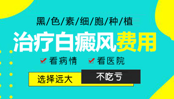 邯郸治疗白癜风最好的医院在哪里