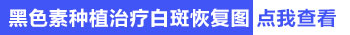 邢台白癜风白斑医院哪家好 邢台白癜风医院