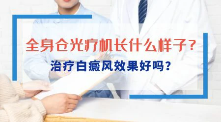 全身仓白癜风照一次多少钱