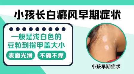 小孩白癜风初期症状图