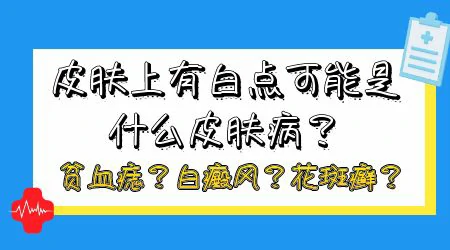 脸上有白块不疼不痒没有扩散是什么病