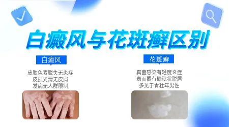 身上长白斑的原因大全