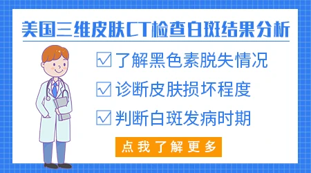 皮肤ct检查白斑效果准不准