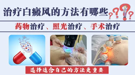 高中生白癜风治疗方法哪种好