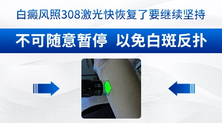 白癜风医院有卖308光疗仪的吗