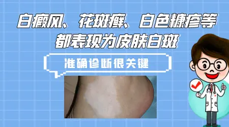 不同类型白斑病区别图