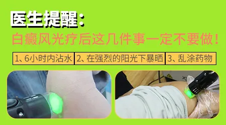 白癜风激光治疗后多久能碰水