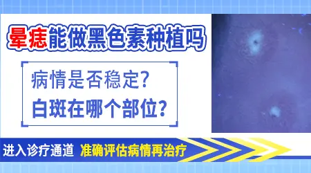 白癜风黑色素种植手术效果对比