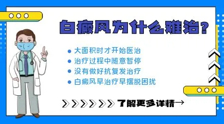 汗斑和白癜风白斑图片对比