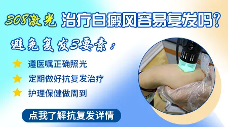 308准分子激光照好白癜风后容易复发吗