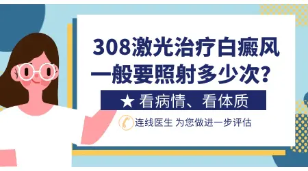 脸上一小片白癜风能否照激光治疗