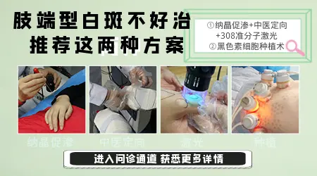 手上白斑早期症状