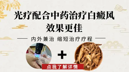 中医中药治白癜风效果好不好