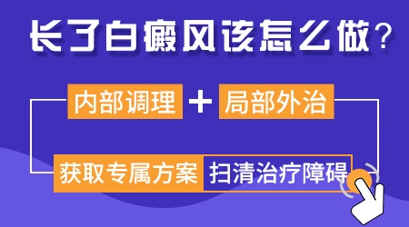 纳晶治疗白癜风是起什么作用