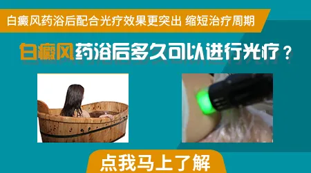 药浴泡澡白癜风的秘方