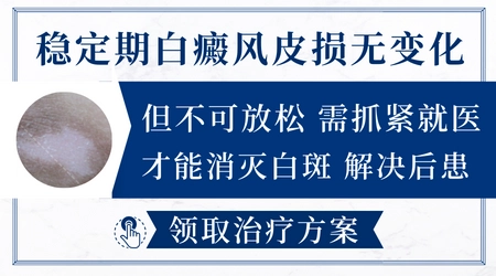 白癜风好几年没扩散要治吗