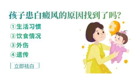 如何治疗小孩白癜风