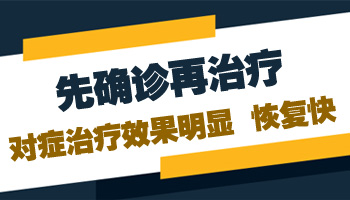 额头白了一小块是不是白癜风