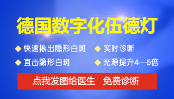 白斑做伍德灯能确诊是不是白癜风吗