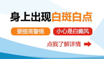 腿上有白点不知道是不是白癜风该怎么判断