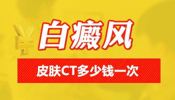 白斑做一回ct检查多少钱