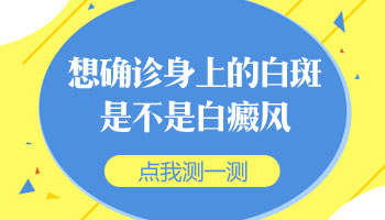 白斑2年多了是什么病