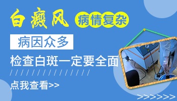 小腿上有点白块是白癜风吗 做什么检查查白斑