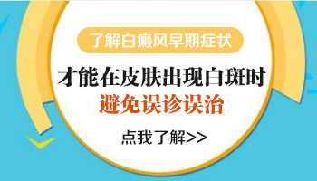 伍德灯能照出早期白癜风吗 初期白斑长什么样