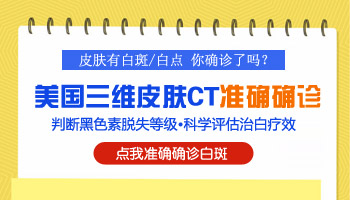 得了白癜风要做皮肤ct检查吗