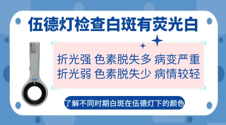 缺少维生素的白斑和白癜风怎么区分