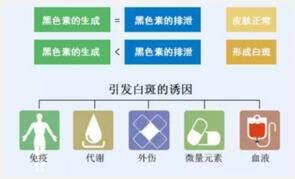 早期双腿白癜风的临床症状