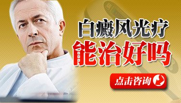 为什么说传统(chuantong)办法(banfa)治疗白癜风不迷信