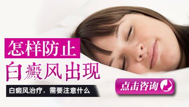 治疗白癜风医生救救我