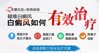 为什么手部白癜风治疗见效比较慢