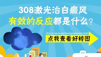 白斑变黑部位还要照308吗 照308白癜风会不会越来越黑