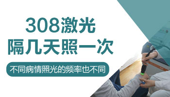 白癜风用308激光一周照几次 白斑大概照几次有效果