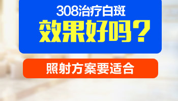 手指端白癜风可以照光吗 白斑照几回能有好转