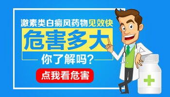 激素治疗白癜风效果如何 激素用多了会刺激白斑吗