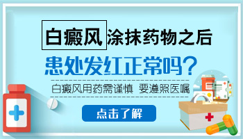 白癜风坚持用药会好转吗 激素药治白斑有效果吗