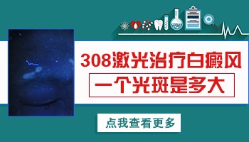 孩子六个月会有白癜风吗 孩子的白癜风怎么治